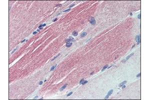 Immunohistochemistry: Human Skeletal Muscle: Formalin-Fixed, Paraffin-Embedded (FFPE). (IGFBP6 anticorps  (Internal Region))