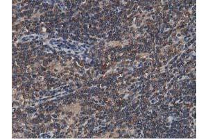 Image no. 5 for anti-Acetyl-CoA Acetyltransferase 2 (ACAT2) antibody (ABIN1496396)