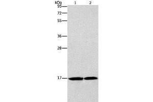 Western Blot analysis of Mouse heart and Human fetal brain tissue using GMFG Polyclonal Antibody at dilution of 1:1142 (GMFG anticorps)