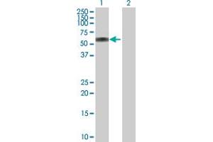 Western Blot analysis of ATP6AP1 expression in transfected 293T cell line by ATP6AP1 MaxPab polyclonal antibody. (ATP6AP1 anticorps  (AA 1-470))
