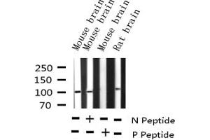Western blot analysis of Phospho-GluR1 (Ser863) expression in various lysates (Glutamate Receptor 1 anticorps  (pSer863))
