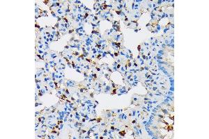 Immunohistochemistry of paraffin-embedded rat lung using RPB3/POLR2C Rabbit mAb (ABIN7269458) at dilution of 1:100 (40x lens).
