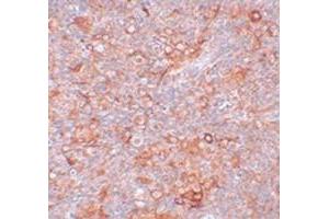 Immunohistochemical staining of mouse thymus tissue with TMEM38B polyclonal antibody  at 5 ug/mL dilution. (TMEM38B anticorps  (C-Term))
