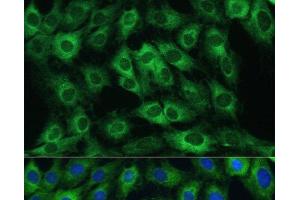 Immunofluorescence analysis of C6 cells using FRMD6 Polyclonal Antibody at dilution of 1:100. (FRMD6 anticorps)