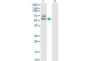 Western Blot analysis of ATP6V1A expression in transfected 293T cell line by ATP6V1A monoclonal antibody (M02), clone 4F5.