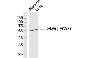 Lane 1: Mouse placenta lysates, Lane 2: Mouse lung lysates probed with Lyn (Tyr397) Polyclonal Antibody, Unconjugated  at 1:300 overnight at 4˚C. (LYN anticorps  (pTyr397))