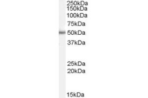 Image no. 1 for anti-Paired Box 6 (PAX6) (Internal Region) antibody (ABIN374758) (PAX6 anticorps  (Internal Region))