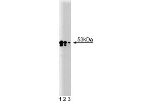 Western Blotting (WB) image for anti-TEA Domain Family Member 1 (SV40 Transcriptional Enhancer Factor) (TEAD1) (AA 86-199) antibody (ABIN968252)