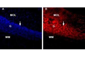 α-Conotoxin ImI-ATTO Fluor-590 stains rat cerebellum. (alpha-conotoxin IMI peptide (Atto 590))