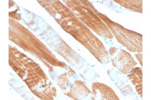 Formalin-fixed, paraffin-embedded human Skeletal Muscle stained with Sarcomeric Actinin Alpha 2 Mouse Monoclonal Antibody (ACTN2/3291).
