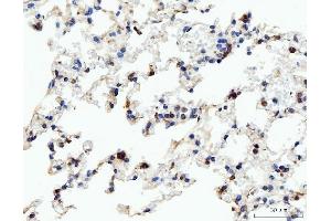 IHC analysis of Acid Phosphatase/ACP5 using anti-Acid Phosphatase/ACP5 antibody (ABIN7601574). (ACP5 anticorps  (AA 39-325))