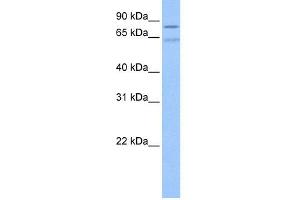 WB Suggested Anti-ZNF724P Antibody Titration:  0. (ZNF724P anticorps  (N-Term))