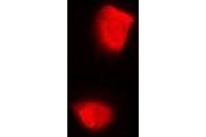 Immunofluorescent analysis of PSMA2 staining in U2OS cells. (PSMA2 anticorps)