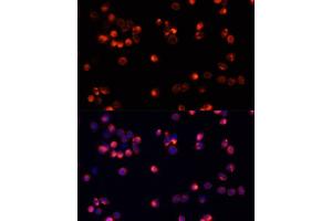 Immunofluorescence analysis of HeLa cells using  antibody (ABIN3020944, ABIN3020945, ABIN3020946 and ABIN6213811) at dilution of 1:100. (AKT2 anticorps)
