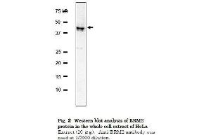 Western Blotting (WB) image for anti-Ribonucleotide Reductase M2 (RRM2) (C-Term) antibody (ABIN2452118)