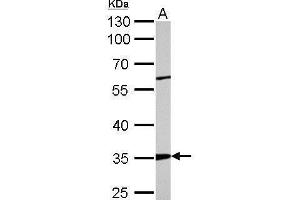 WB Image ARPC2 antibody detects ARPC2 protein by Western blot analysis.