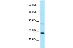 WB Suggested Anti-CTDSP1 Antibody Titration: 1.