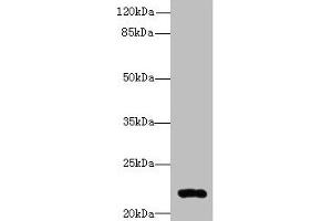 Western blot All lanes: ARL14 antibody at 0. (ARL14 anticorps  (AA 2-192))