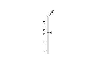 Western blot analysis of lysate from human ovary tissue lysate, using LRRN4CL Antibody (Center) (ABIN656629 and ABIN2845875). (LRRN4CL anticorps  (AA 117-146))