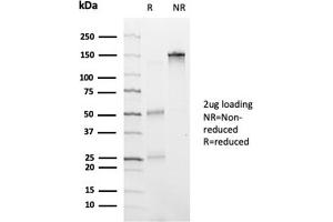 SDS-PAGE Analysis Purified HDAC6 Mouse Monoclonal Antibody (PCRP-HDAC6-1A4). (HDAC6 anticorps)