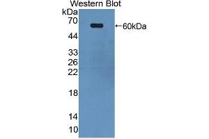 Western blot analysis of the recombinant protein. (EPH Receptor A4 anticorps  (AA 621-882))