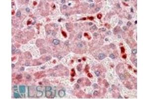 Image no. 3 for anti-PYD and CARD Domain Containing (PYCARD) (C-Term) antibody (ABIN374154) (PYCARD anticorps  (C-Term))