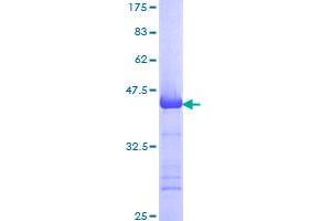 Image no. 1 for Minichromosome Maintenance Complex Component 3 (MCM3) (AA 699-808) protein (GST tag) (ABIN1310549)