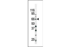 The anti-Phospho-SD3- Pab (ABIN389657 and ABIN2839640) is used in Western blot to detect Phospho-SD3- in Ramos tissue lysate (SMAD3 anticorps  (pSer213))