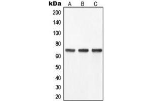 Western blot analysis of YAP1 expression in SW480 (A), HeLa (B), Caco2 (C) whole cell lysates. (YAP1 anticorps  (Center))