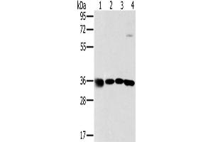 Western Blotting (WB) image for anti-Mitochondrial Ribosomal Protein L39 (MRPL39) antibody (ABIN2423813) (MRPL39 anticorps)