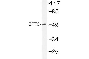 Image no. 1 for anti-Suppressor of Ty 3 Homolog (SUPT3H) antibody (ABIN272144) (SUPT3H/SPT3 anticorps)