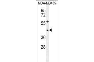 EPHX3 Antibody (C-term) (ABIN655588 and ABIN2845075) western blot analysis in MDA-M cell line lysates (35 μg/lane). (ABHD9 anticorps  (C-Term))