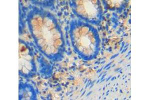IHC-P analysis of rectum tissue, with DAB staining. (FES anticorps  (AA 509-766))