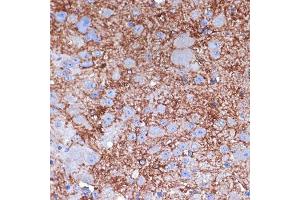 Immunohistochemistry of paraffin-embedded mouse spinal cord using NPY Rabbit pAb (ABIN3017528, ABIN3017529, ABIN3017530 and ABIN6220138) at dilution of 1:100 (40x lens).