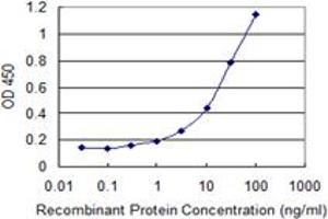 Detection limit for recombinant GST tagged ZYX is 0. (ZYX anticorps  (AA 1-572))
