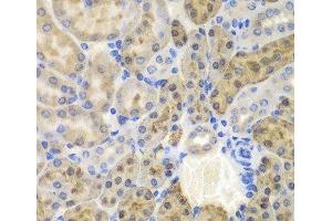 Immunohistochemistry of paraffin-embedded Mouse kidney using AKR1A1 Polyclonal Antibody at dilution of 1:100 (40x lens). (AKR1A1 anticorps)