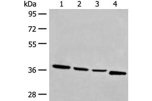 Western blot analysis of Human breast cancer tissue TM4 231 and Jurkat cell lysates using OTUD6A Polyclonal Antibody at dilution of 1:550 (OTUD6A anticorps)