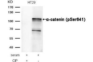 Western blot analysis of extracts from HT29 cells, treated with serum or calf intestinal phosphatase (CIP), using α-catenin (Phospho-Ser641) Antibody. (CTNNA1 anticorps  (pSer641))