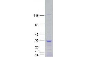 Validation with Western Blot