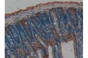 DAB staining on IHC-P; Samples: Rat Intestine Tissue (TFPI anticorps  (AA 29-302))