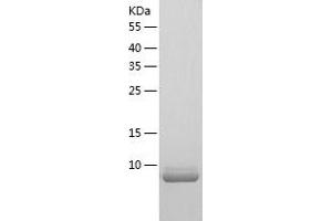 Western Blotting (WB) image for Heat Shock 10kDa Protein 1 (Chaperonin 10) (HSPE1) (AA 1-102) protein (His tag) (ABIN7123261) (HSPE1 Protein (AA 1-102) (His tag))