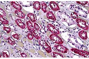 Human Kidney, Tubules: Formalin-Fixed, Paraffin-Embedded (FFPE) (DHX9 anticorps  (AA 1-91))