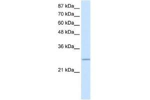 Transfected 293T; WB Suggested Anti-C20ORF20 Antibody Titration: 0.
