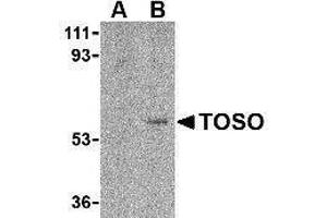 Western Blotting (WB) image for anti-Fas Apoptotic Inhibitory Molecule 3 (FAIM3) (C-Term) antibody (ABIN2476897) (FAIM3 anticorps  (C-Term))