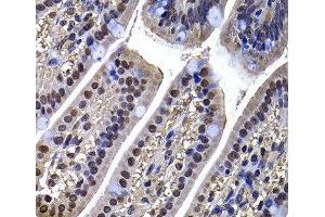 Immunohistochemistry of paraffin-embedded Mouse ileum using DNAJB6 Polyclonal Antibody at dilution of 1:100 (40x lens).
