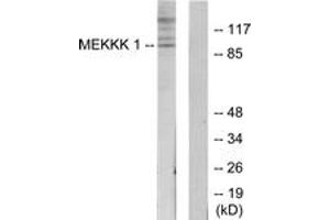 Western blot analysis of extracts from HepG2 cells, using MEKKK 1 Antibody. (MAP4K1 anticorps  (AA 371-420))