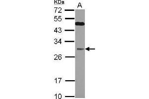 WB Image Sample (30 ug of whole cell lysate) A: Jurkat 12% SDS PAGE antibody diluted at 1:1000 (QDPR anticorps)