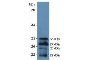Detection of Recombinant FOXO1, Mouse using Polyclonal Antibody to Forkhead Box Protein O1 (FOXO1) (FOXO1 anticorps  (AA 222-469))