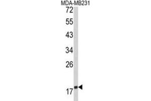Western Blotting (WB) image for anti-CD28 (CD28) antibody (ABIN3002911) (CD28 anticorps)