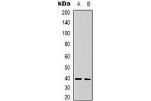 Western blot analysis of CALHM1 expression in human brain (A), rat brain (B) whole cell lysates. (CALHM1 anticorps)